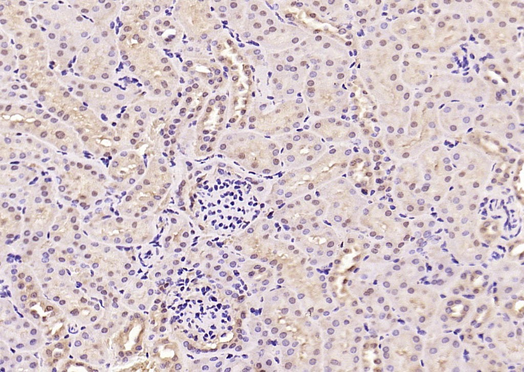 Anti-Phospho-Smad3 (Thr179) Polyclonal Antibody