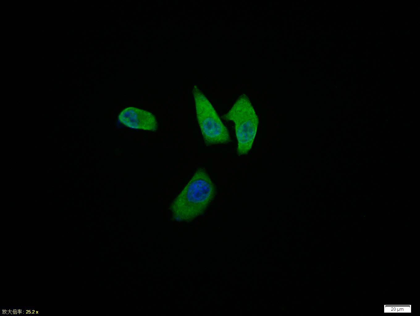 Anti-Phospho-Smad3 (Thr179) Polyclonal Antibody