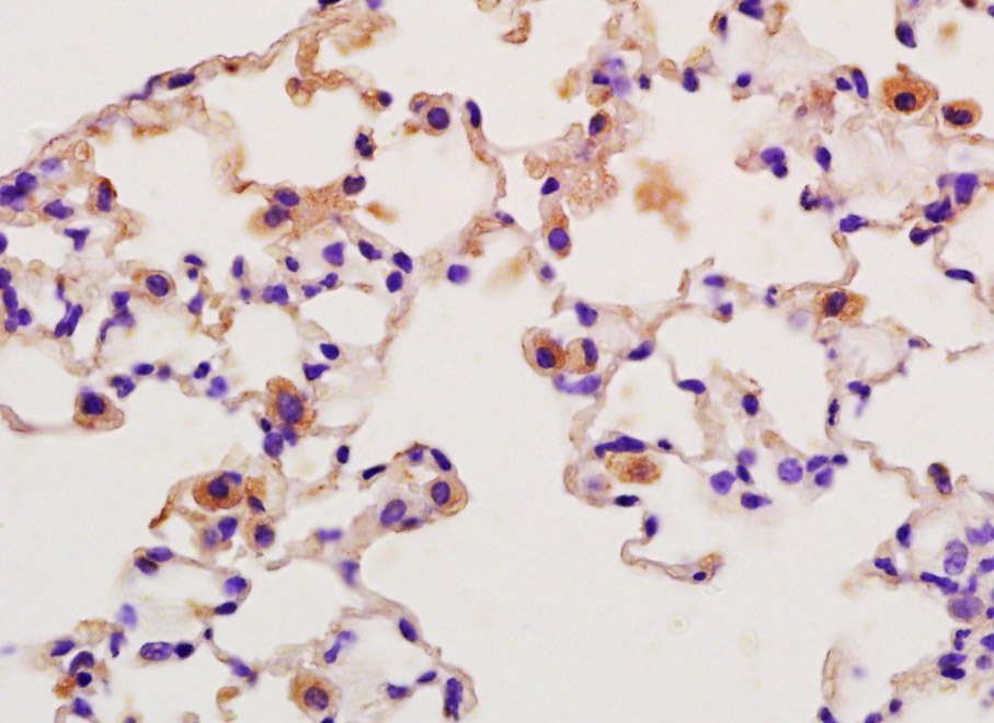 Anti-SFTPA1 Polyclonal Antibody