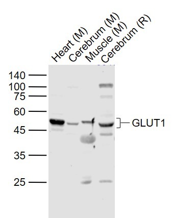 Anti-SLC2A1 Polyclonal Antibody