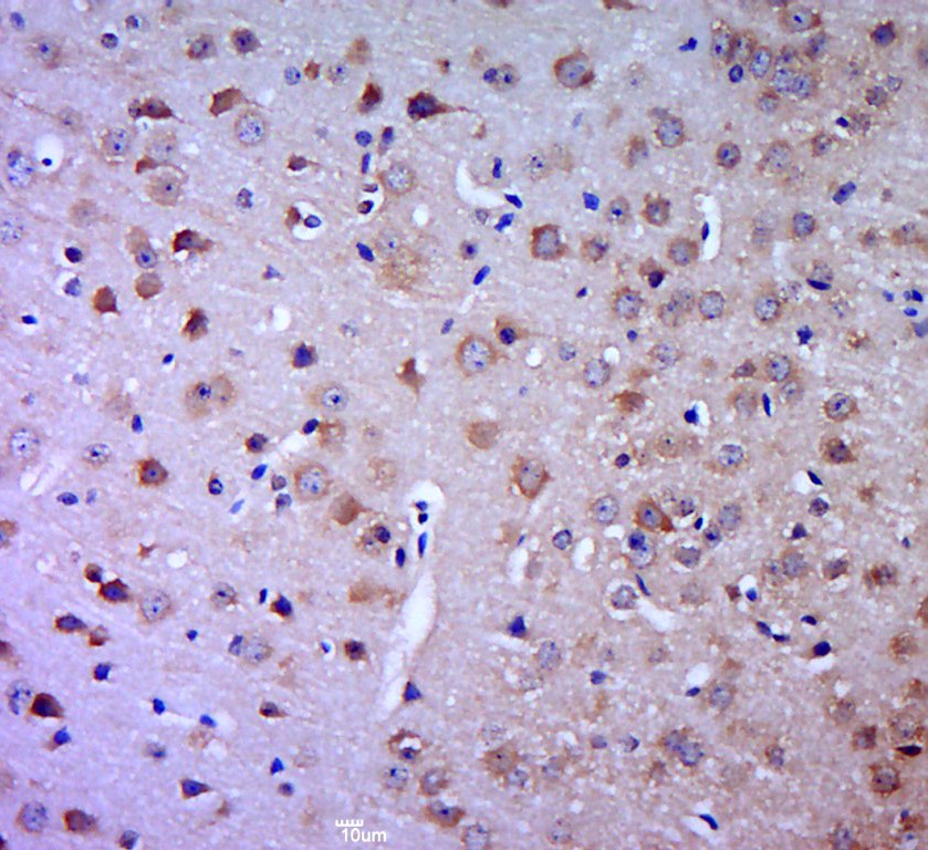 Anti-SLC22A17 Polyclonal Antibody 2