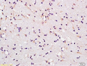 Anti-SLC16A1 Polyclonal Antibody