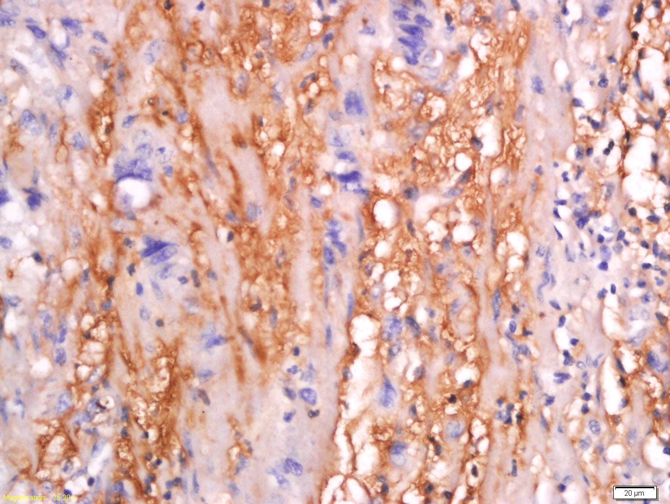 Anti-SFRP4 Polyclonal Antibody