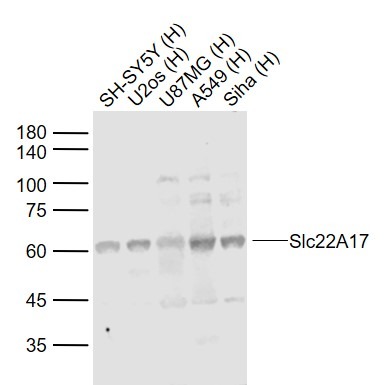 Anti-SLC22A17 Polyclonal Antibody
