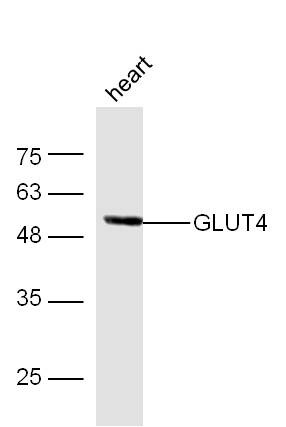 Anti-SLC2A4 Polyclonal Antibody