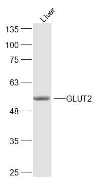 Anti-SLC2A2 Polyclonal Antibody 2