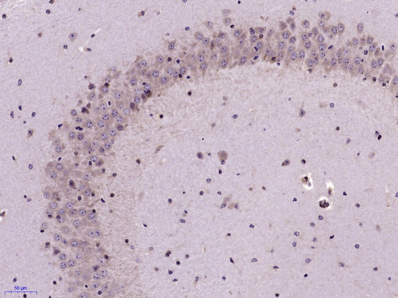 Anti-Serotonin transporter Polyclonal Antibody