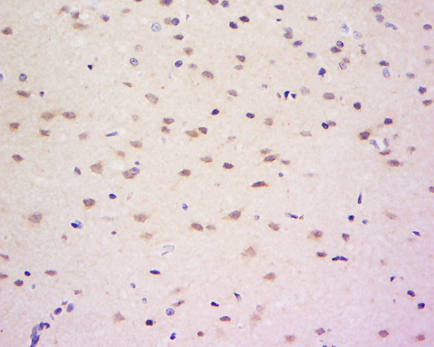 Anti-Serpin A3 Polyclonal Antibody