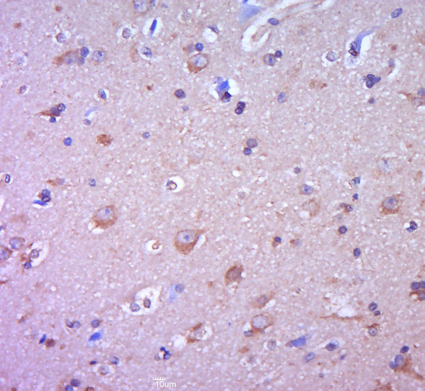 Anti-SLC22A17 Polyclonal Antibody 2