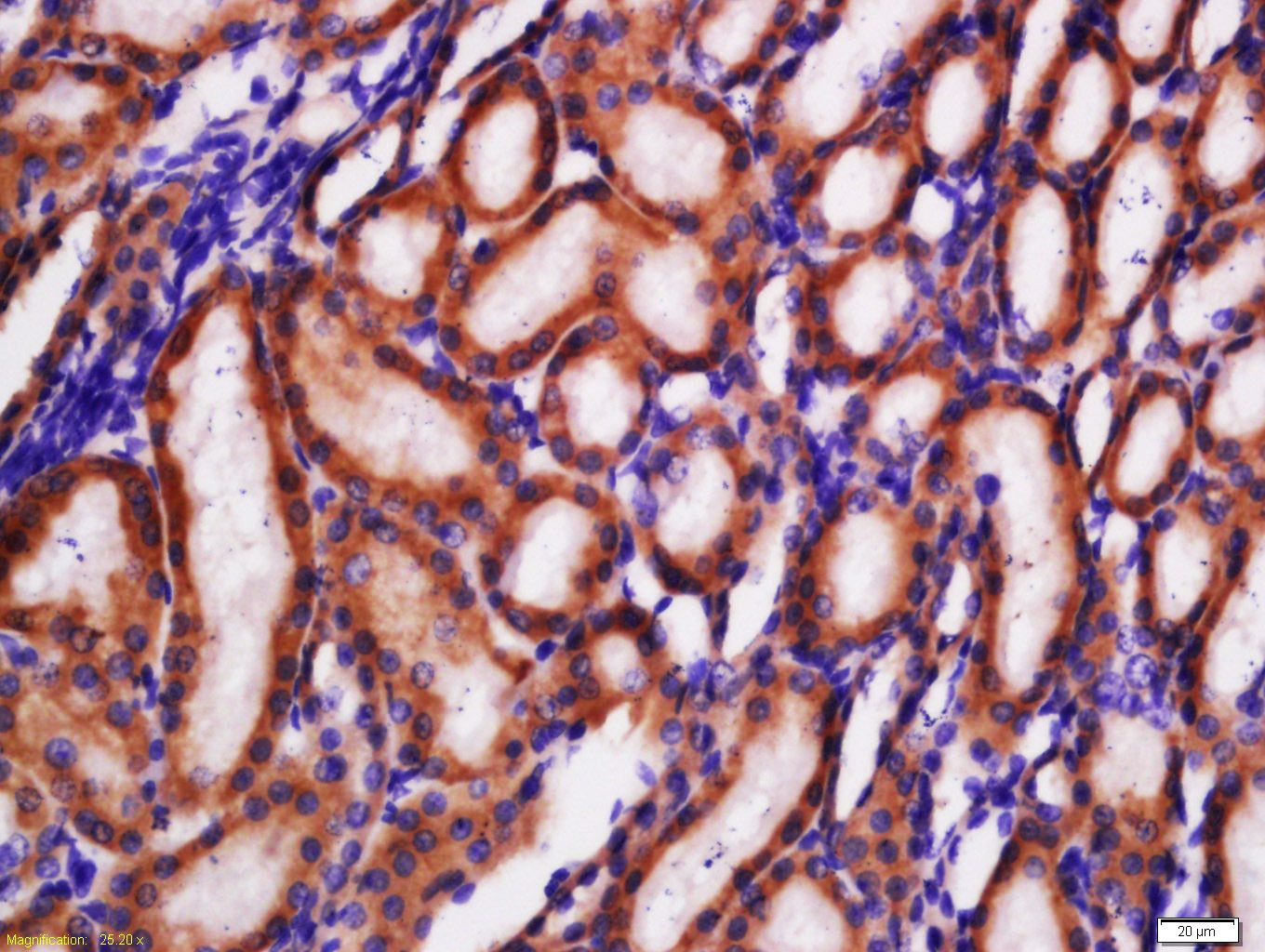 Anti-SLC2A2 Polyclonal Antibody 2