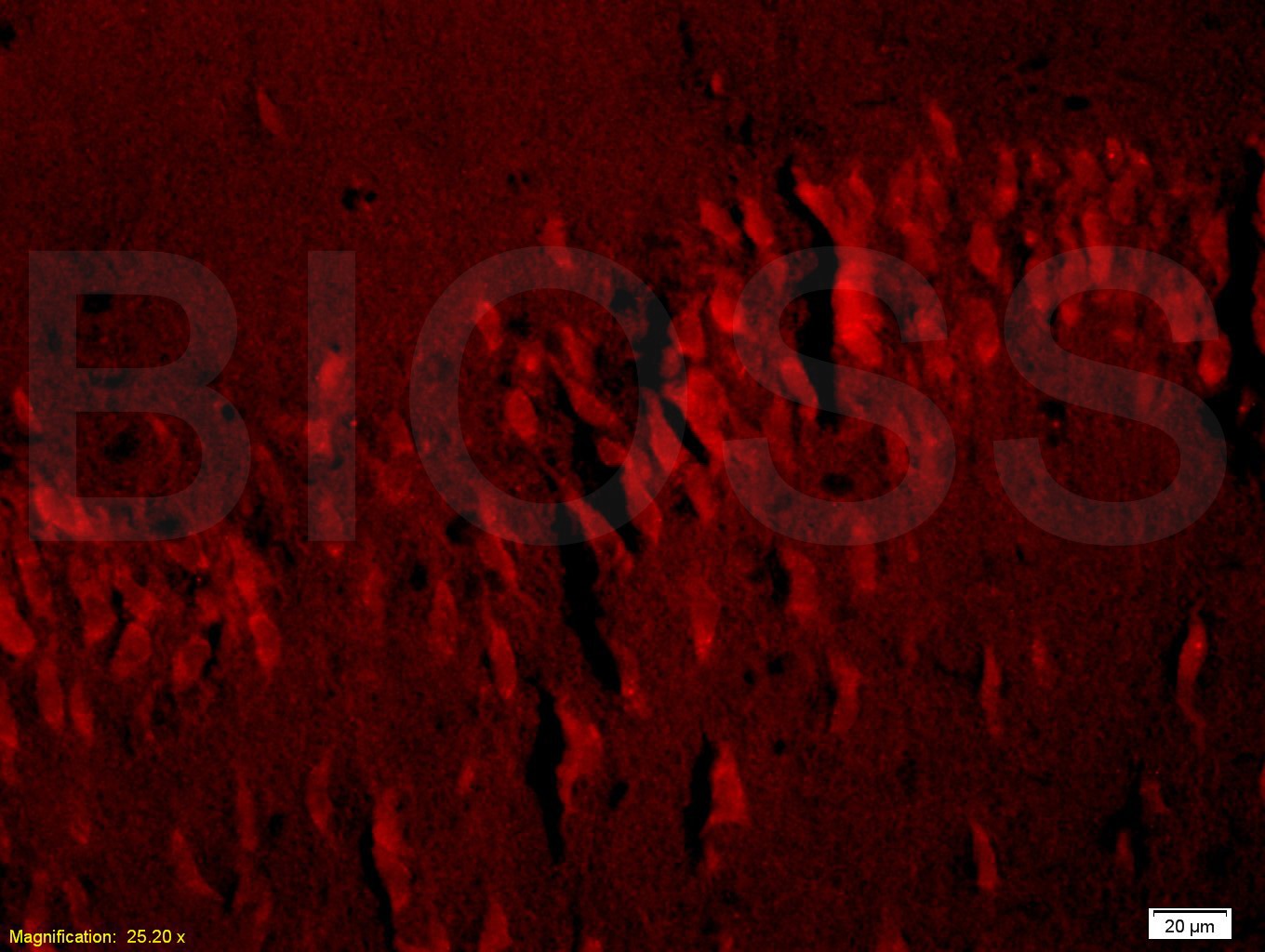 Anti-SLC2A3 Polyclonal Antibody