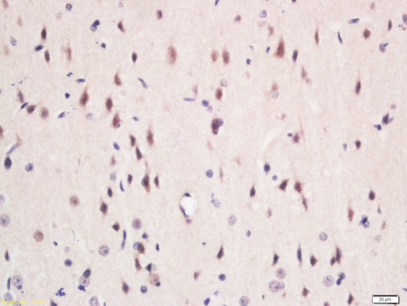 Anti-SLC2A6 Polyclonal Antibody