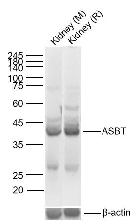 Anti-SLC10A2 Polyclonal Antibody 2