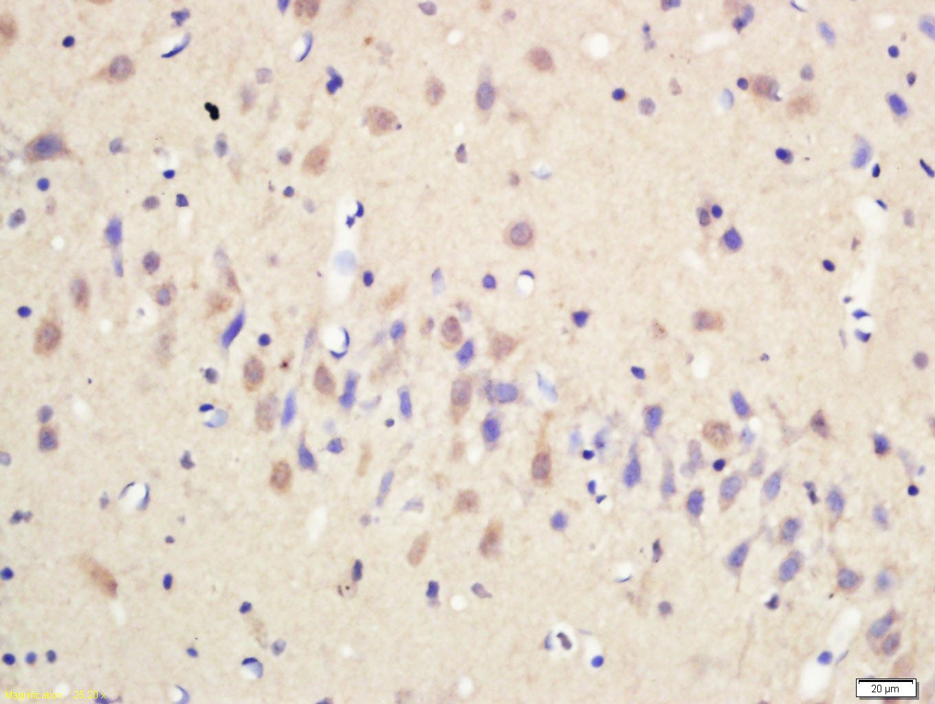 Anti-Serotonin Polyclonal Antibody