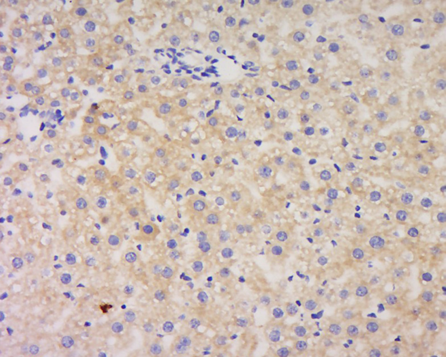 Anti-Serpin A3 Polyclonal Antibody