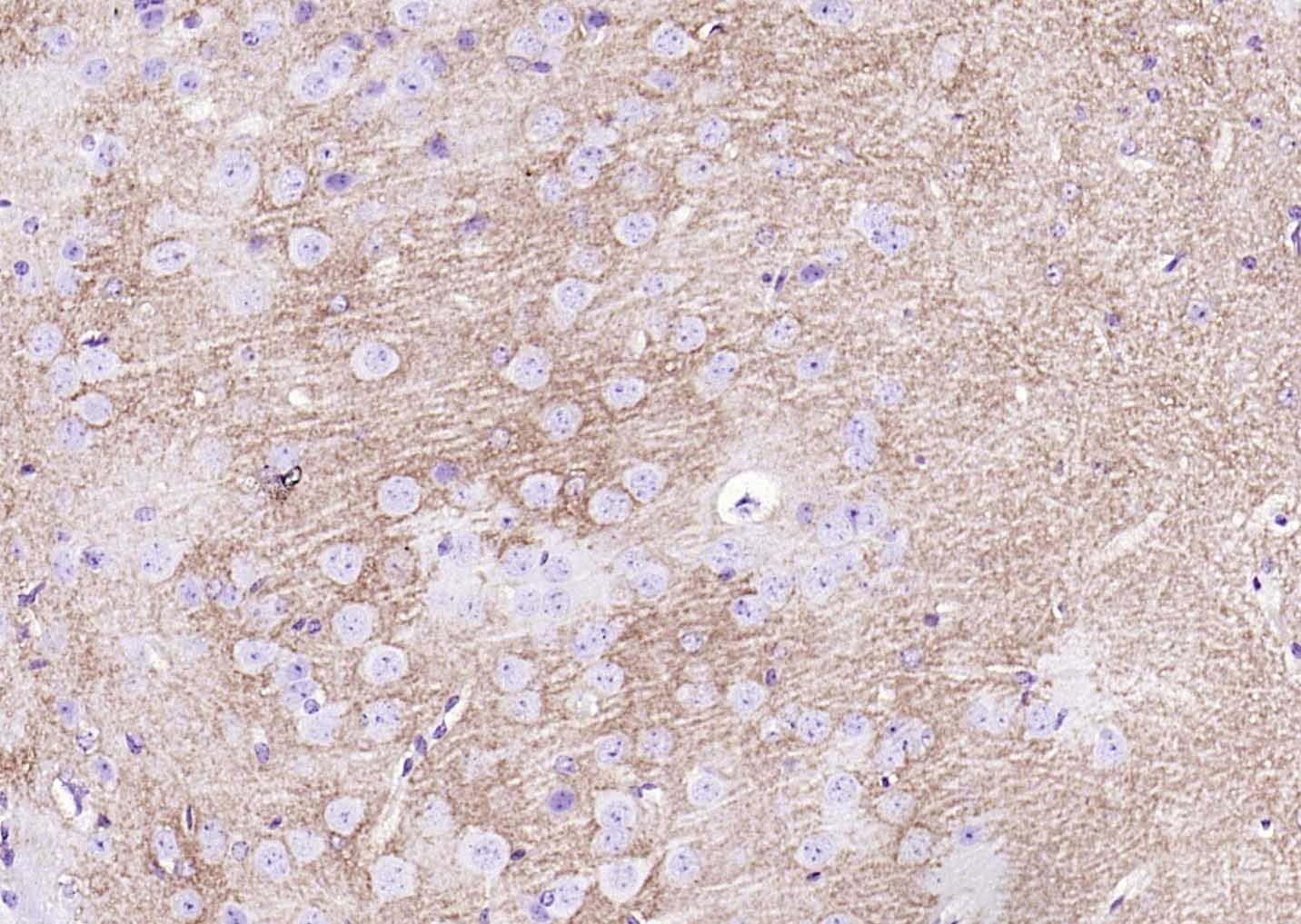 Anti-SLC1A3 Polyclonal Antibody