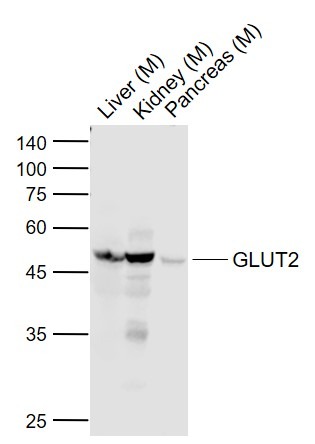 Anti-SLC2A2 Polyclonal Antibody 2