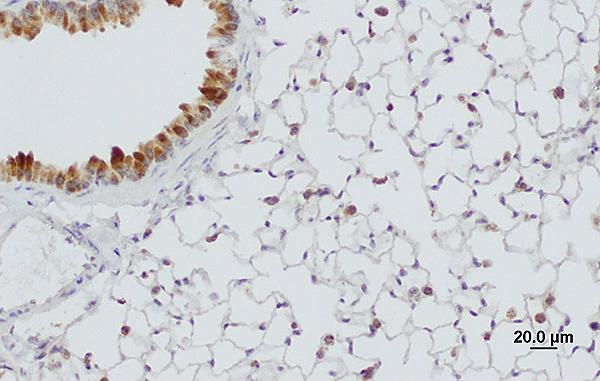 Anti-SFTPA1 Polyclonal Antibody