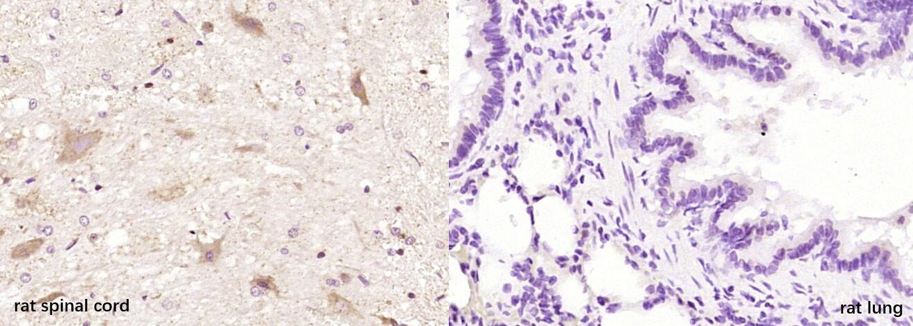 Anti-SLC17A6 Polyclonal Antibody
