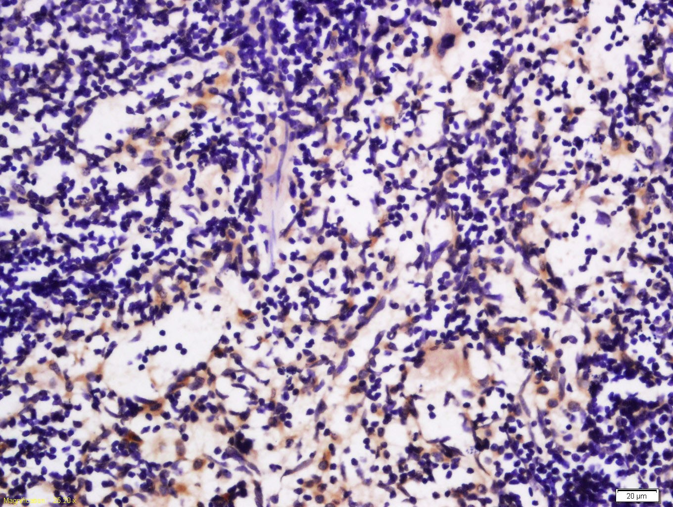 Anti-SLC2A6 Polyclonal Antibody