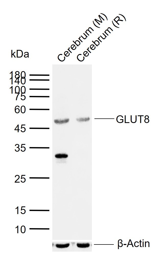 Anti-SLC2A8 Polyclonal Antibody