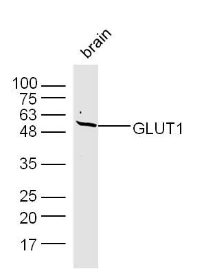 Anti-SLC2A1 Polyclonal Antibody 3