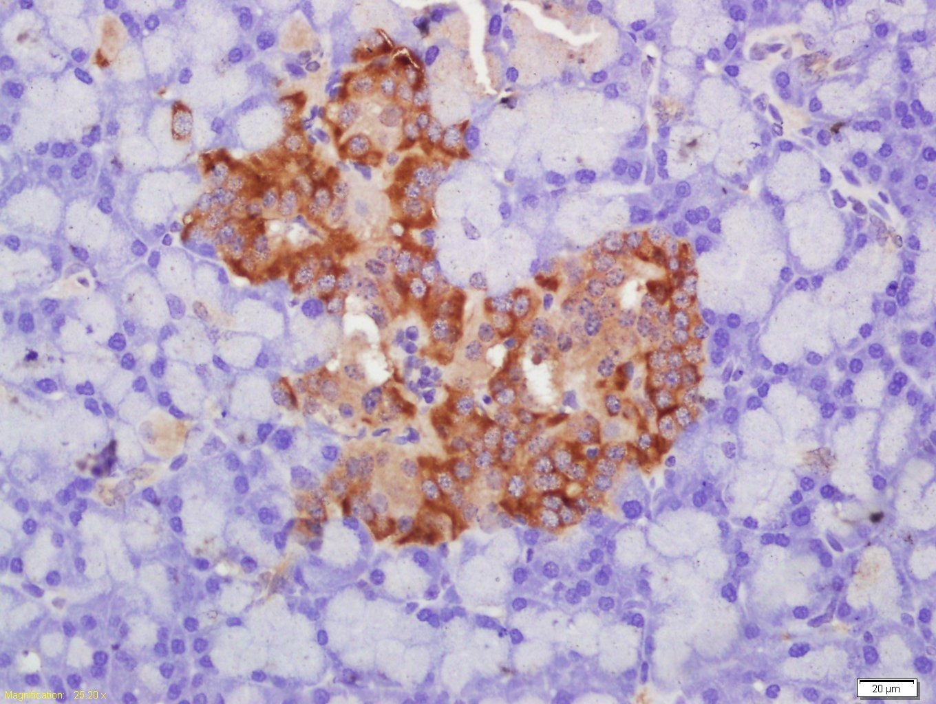 Anti-SLC2A2 Polyclonal Antibody