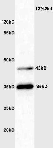 Anti-Shiga-like toxin IIe variant subunit A Polyclonal Antibody