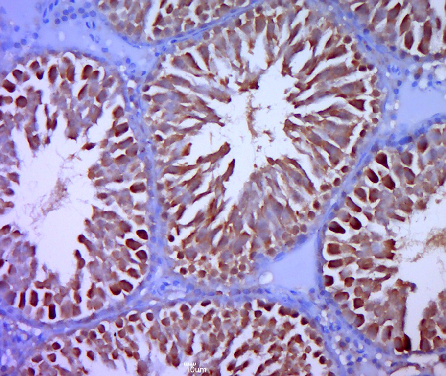 Anti-SHBG Polyclonal Antibody