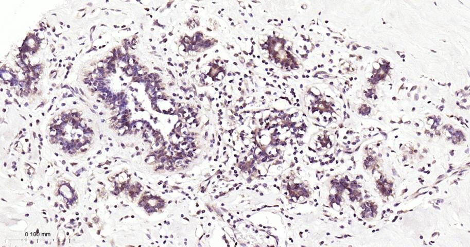 Anti-SMAD4 Antibody (1D720)
