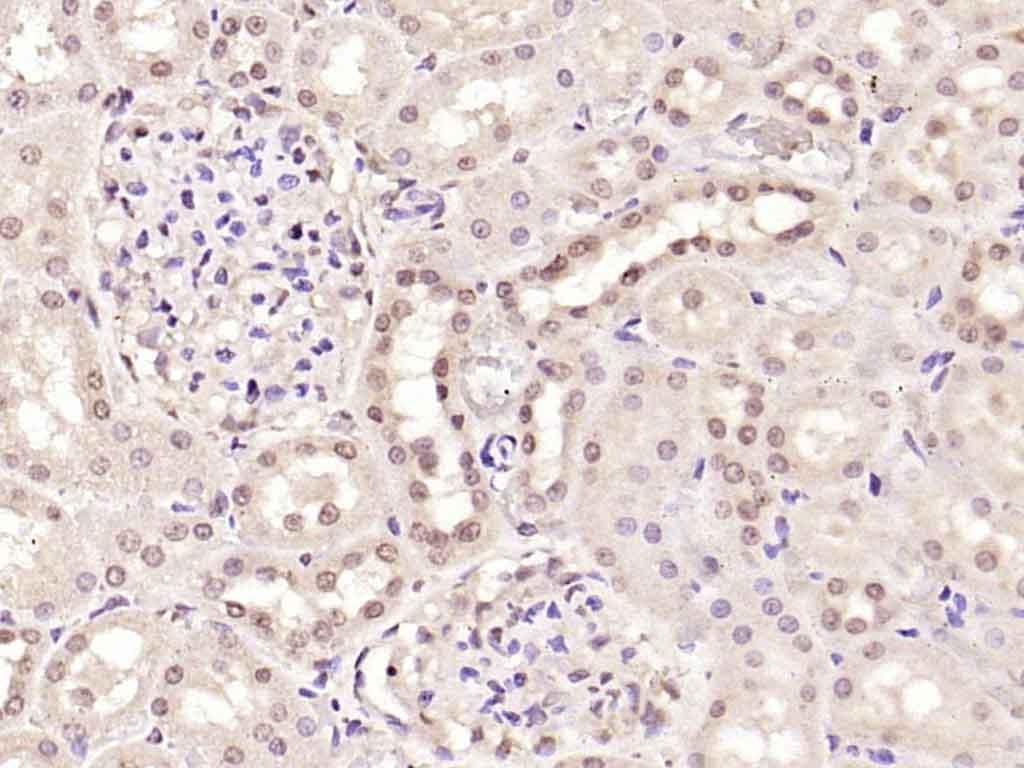 Anti-SMAD7 Polyclonal Antibody