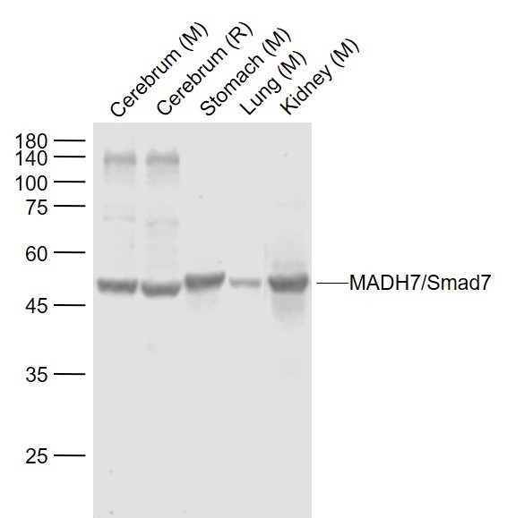Anti-SMAD7 Polyclonal Antibody