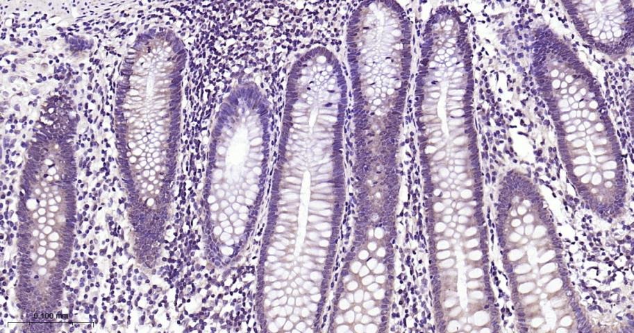 Anti-SMAD4 Antibody (1D720)