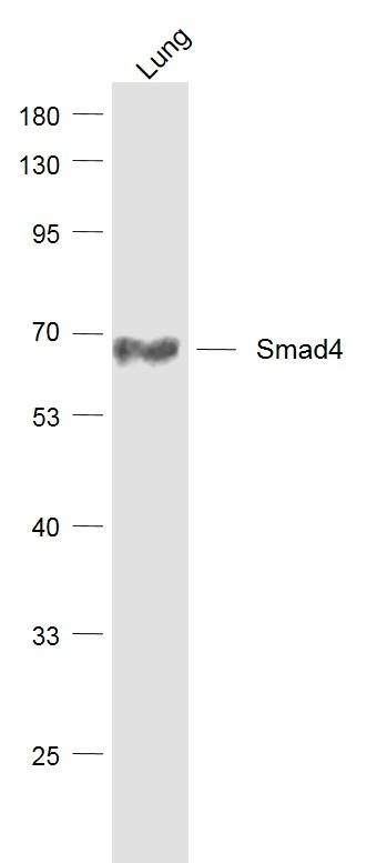 Anti-SMAD4 Antibody (1D720)