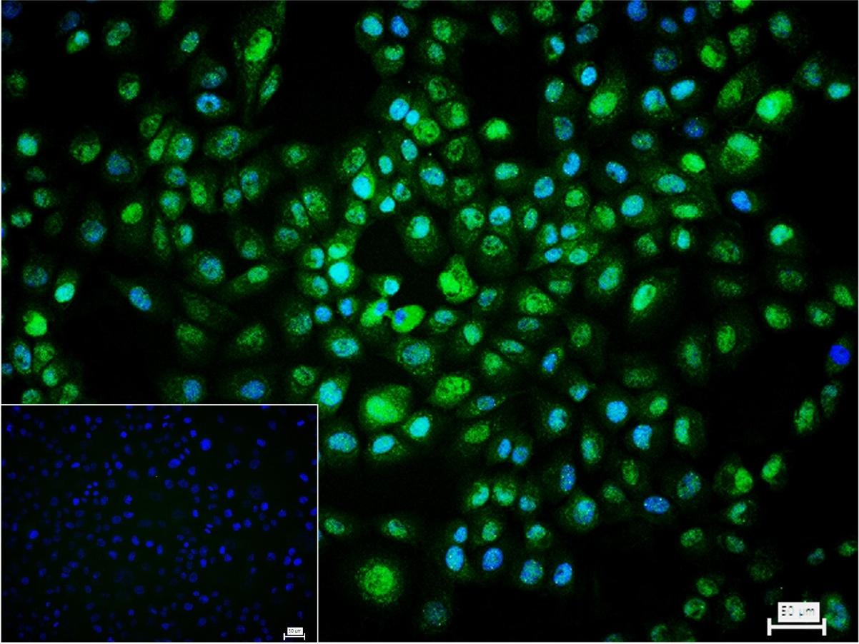 Anti-SMAD3 Antibody (8P334)