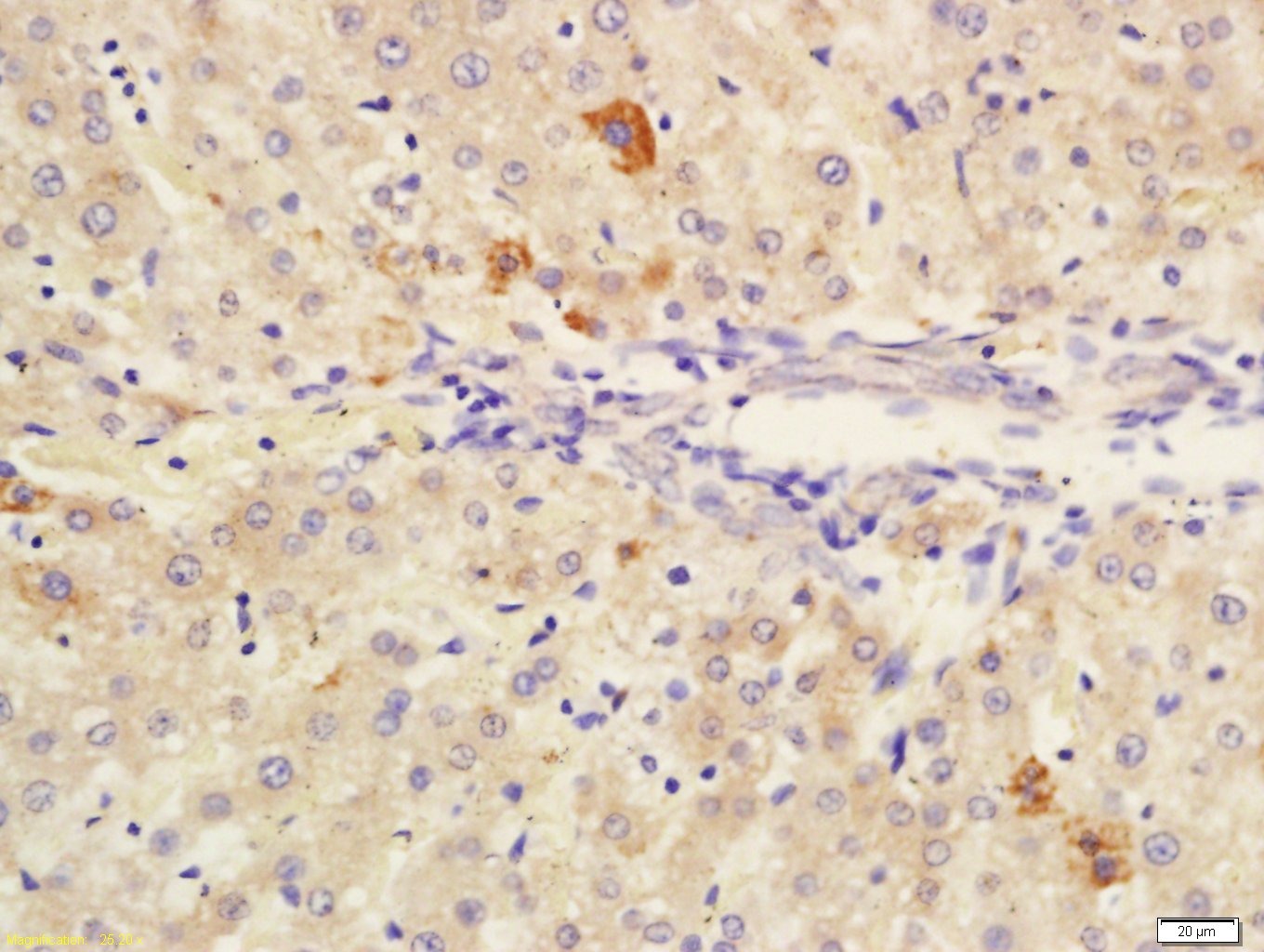 Anti-CES1 Polyclonal Antibody