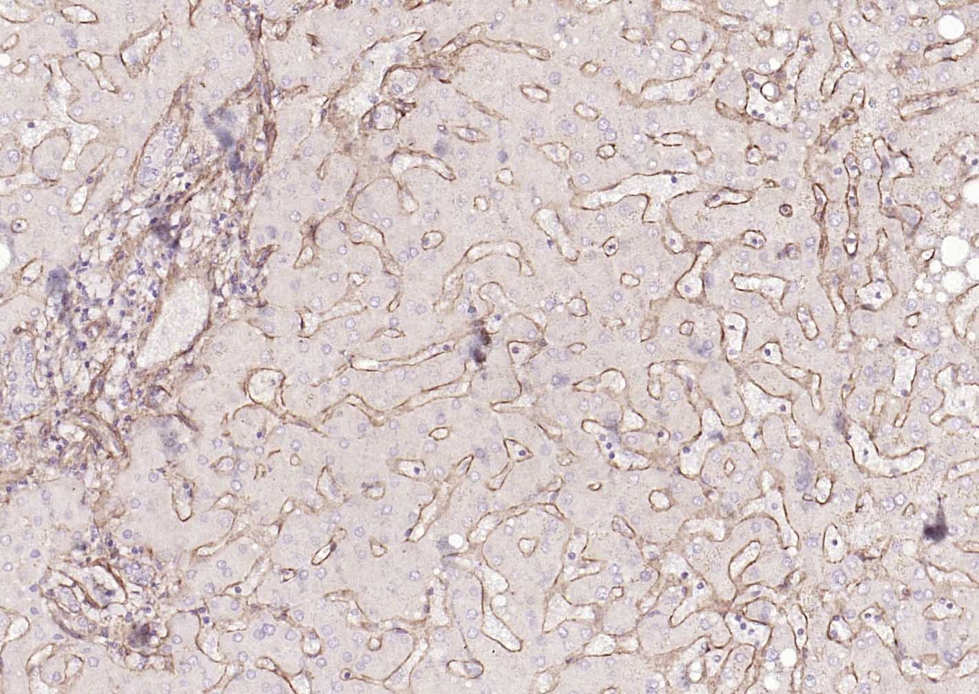 Anti-Collagen IV/COL4A1 Polyclonal Antibody 2