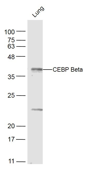 Anti-CEBP beta Polyclonal Antibody