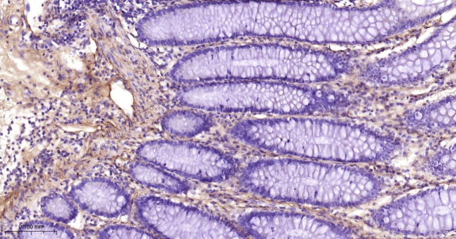 Anti-Collagen III/COL3A1 Polyclonal Antibody