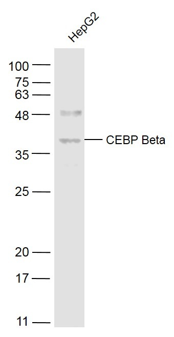 Anti-CEBP beta Polyclonal Antibody