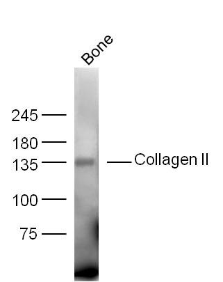 Anti-Collagen II/COL2A1 Polyclonal Antibody 2