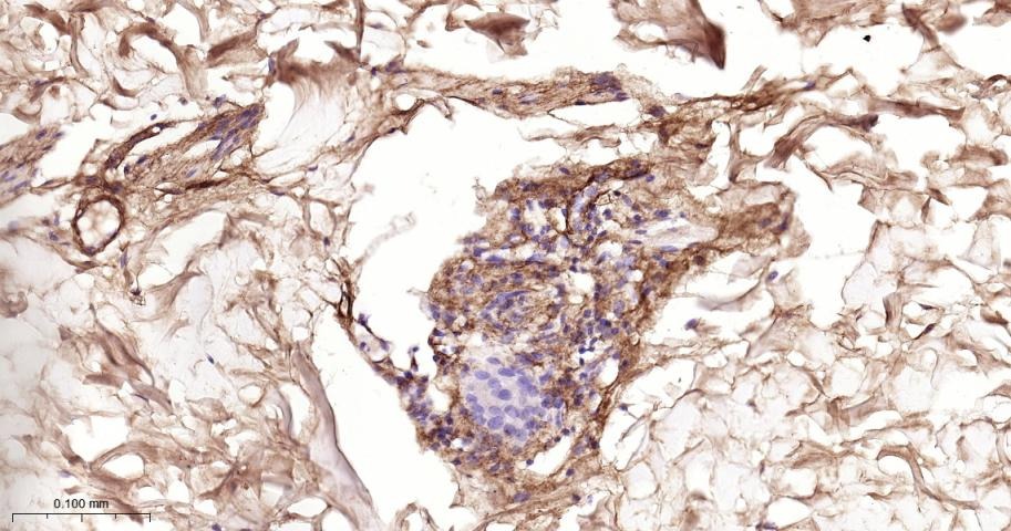 Anti-Collagen III/COL3A1 Polyclonal Antibody