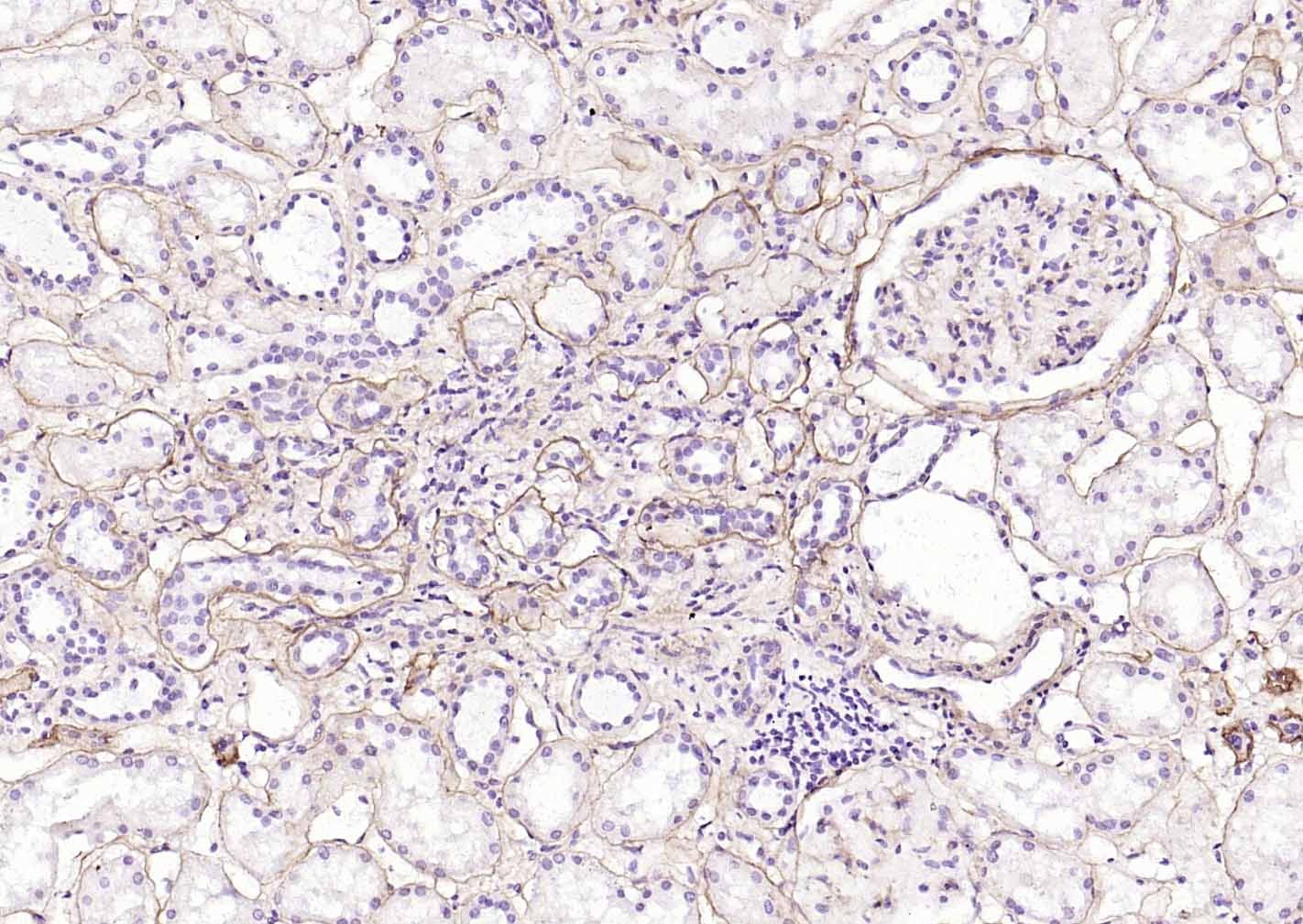 Anti-Collagen IV/COL4A1 Polyclonal Antibody 2