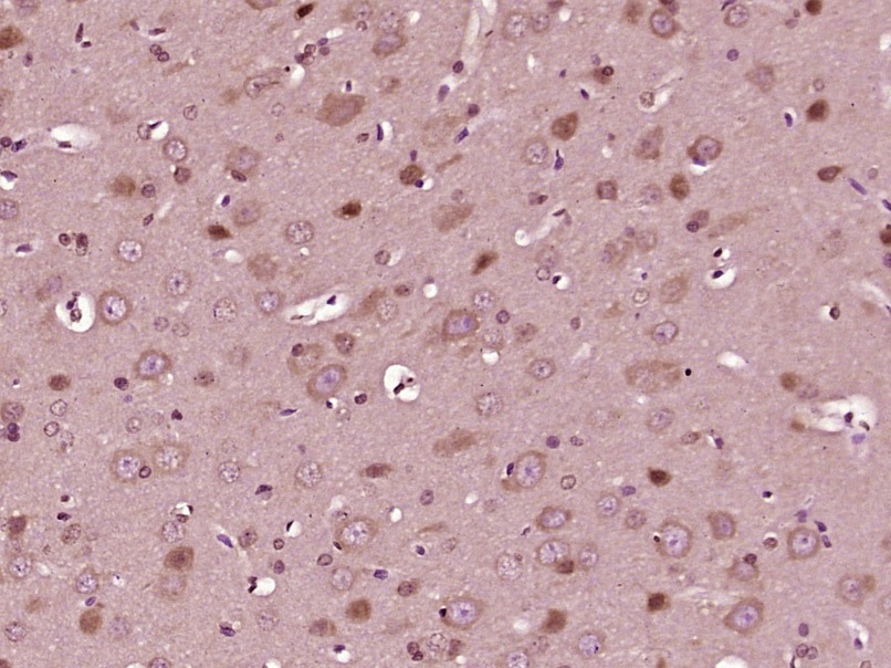 Anti-Collagen X/COL10A1 Polyclonal Antibody