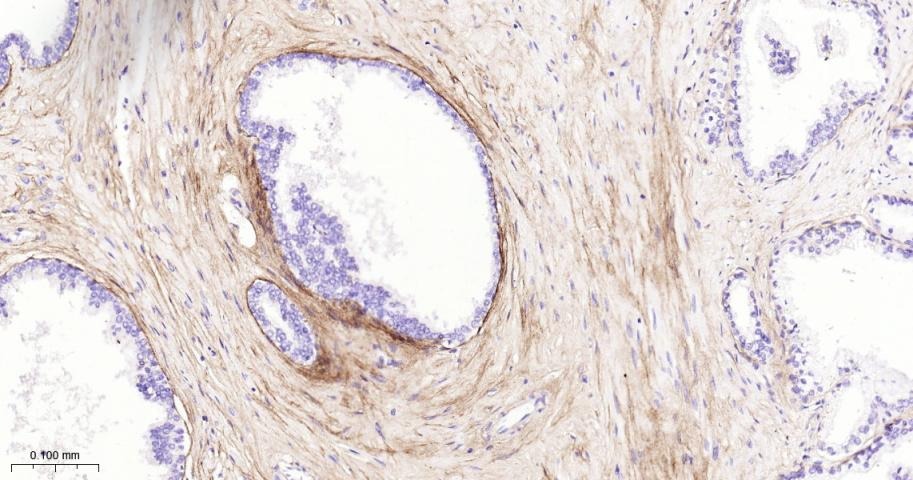 Anti-Collagen III/COL3A1 Polyclonal Antibody