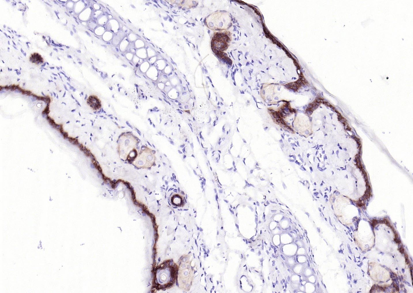 Anti-Collagen XVII/COL17A1 Antibody (3R637)