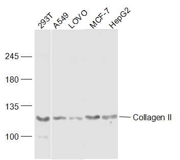 Anti-Collagen II/COL2A1 Polyclonal Antibody 2
