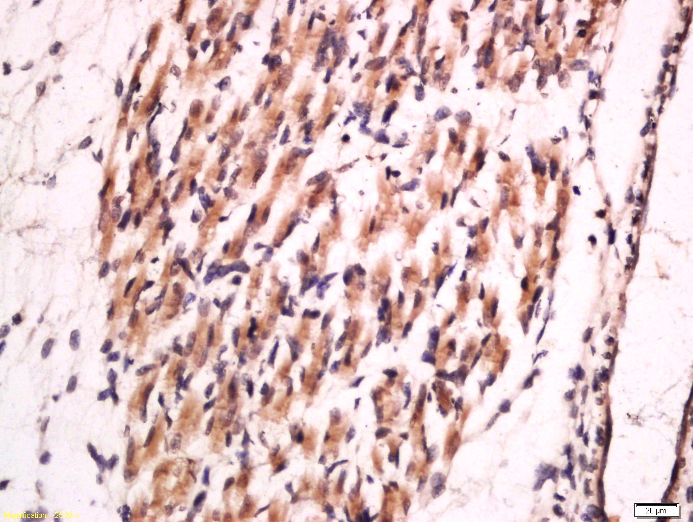 Anti-Collagen II/COL2A1 Polyclonal Antibody 2
