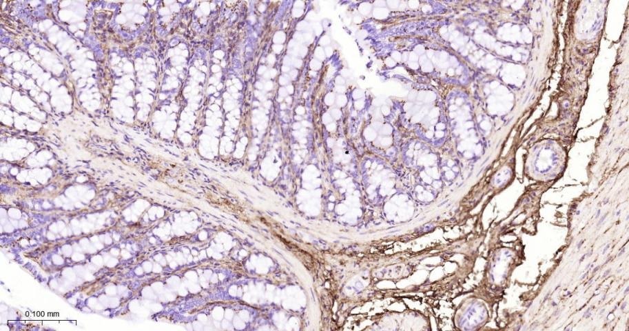 Anti-Collagen III/COL3A1 Polyclonal Antibody
