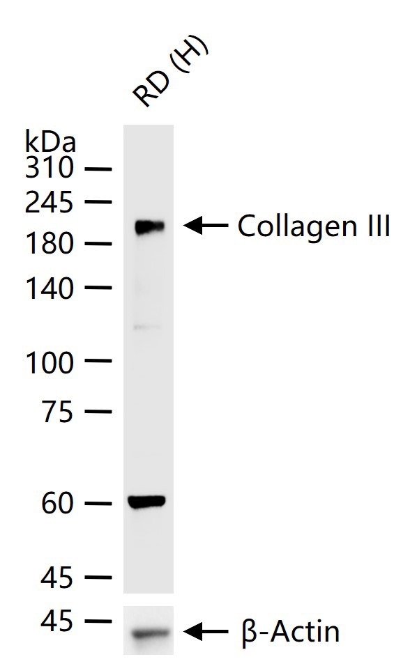 Anti-Collagen III/COL3A1 Polyclonal Antibody 2